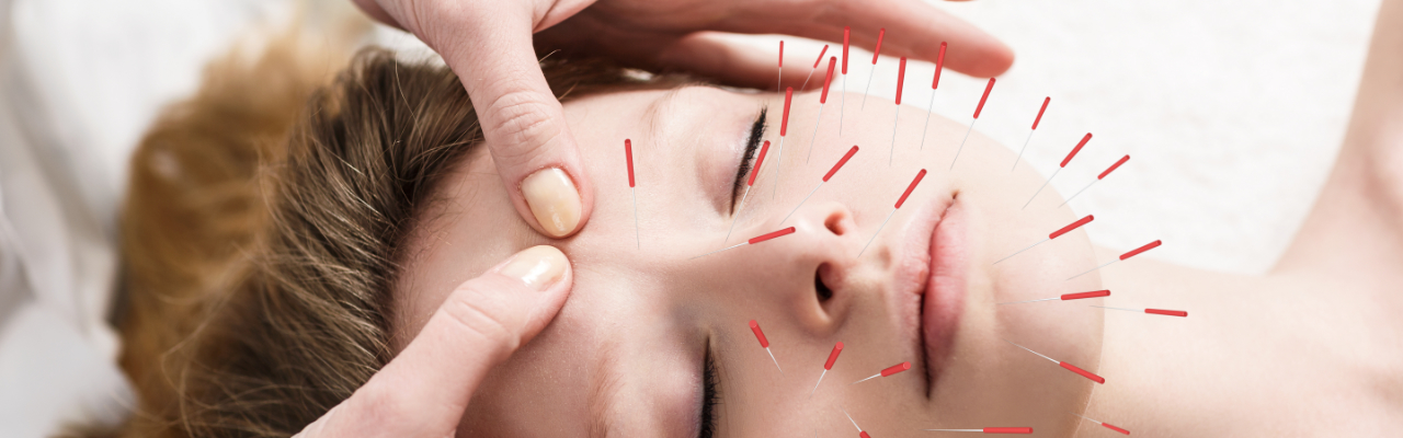 Facial Revitalisation Acupuncture